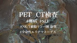 【PET CT検査】NKT細胞リンパ腫鼻型SLE全身性エリテマトーデス膠原病難病PETCT [upl. by Ymmit]