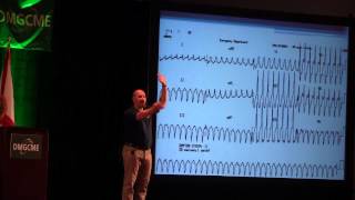 Understanding Ventricular Tachycardia [upl. by Wieren131]