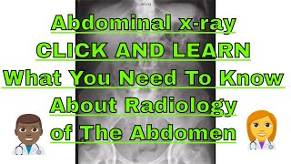 Abdominal x ray Normal abdominal x ray Learn Abdominal xray interpretation [upl. by Claresta218]