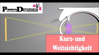 Wie kommt es zu Kurz und Weitsichtigkeit  einfach und anschaulich erklärt [upl. by Akelam612]