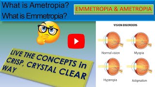 WHAT IS EMMETROPIA  WHAT IS AMETROPIA [upl. by Atahs]