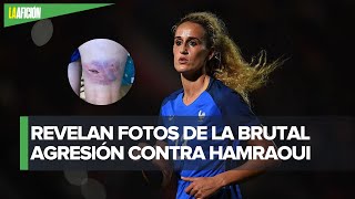 Kheira Hamraoui muestra las lesiones de su violenta agresión [upl. by Terryn]