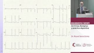 Arritmias benignas y práctica deportiva Dr Ricard Serra Grima [upl. by Enilrek]