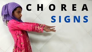 Understanding Chorea Common Signs in Children Chorea Signs [upl. by Attenreb]