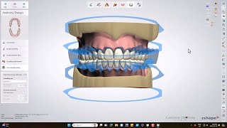 Ivotion Monolithic Denture Design [upl. by Yenruoj]