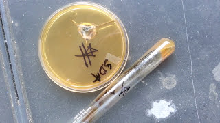 Cladosporium spp   Mycology [upl. by Eden469]