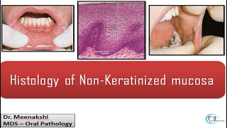 Histology Of Non Keratinised Mucosa [upl. by Epoh]