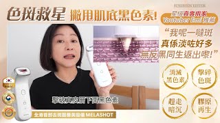 【真實用家Youtuber Emi摯愛私藏推薦😍去斑救星】韓國醫療協會認證的IPL脈衝光技術💫去斑醫療美容儀Melashot [upl. by Ranie]