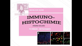 Immunohistochimie Etapes du protocole [upl. by Moersch758]