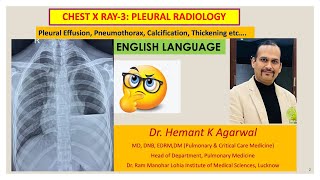 Radiology Chest X Ray 3 ENGLISH Pleural Effusion pneumothorax ThickeningDr Hemant K Agarwal [upl. by Marlane312]