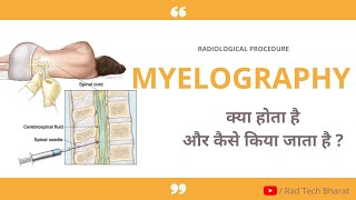 Myelography Procedure क्या होता है और कैसे किया जाता है [upl. by Hassadah]