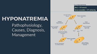 Hyponatremia  Pathophysiology Causes Diagnostic Approach amp Management 😊 AllinOne Package 😊 [upl. by Matejka]