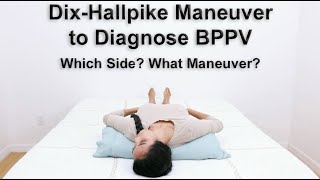 Dix Hallpike Maneuver to Diagnose BPPV  What Side and What Type for Proper Treatment [upl. by Quintilla]