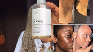 HOW TO EFFECTIVELY USE GLYCOLIC ACID TO CLEAR DARKSPOTS  TRANSFORMED SKINCARE ROUTINE [upl. by Frame]