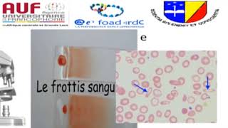 MORPHOLOGIE EN HEMATOLOGIE EPISODE 6 [upl. by Imre557]