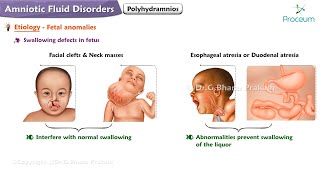 Amniotic Fluid Disorders Polyhydramnios [upl. by Avihs]