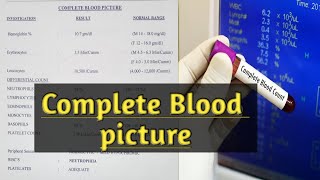 CBP Complete Blood Picture Test in Pregnancy II CBP and OGTT Test Reports II Yashu Telugu Ammai [upl. by Noedig]