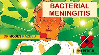 Bacterial Meningitis [upl. by Ynaffat]