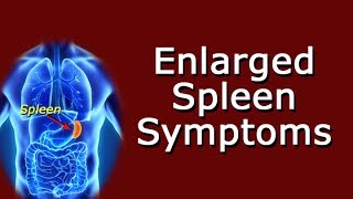 Enlarged Spleen Symptoms [upl. by Notsnorb]