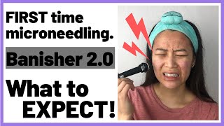 Banisher 20 First Impressions Dermastamping  Microneedling for Acne and Textured Skin [upl. by Cranford]