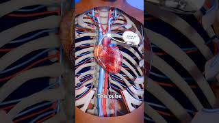 Pacemaker pacemaker heart cardiology heartattack shorts medical nursing viralvideo stunt [upl. by Sirhc]