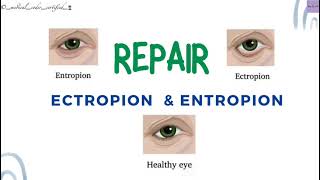 REPAIR ECTROPION amp ENTROPION CPT TOPICS MEDICAL CODING AND BILLING medicalcodercertified [upl. by Lyrred648]