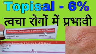 Topisal  6 Uses in Hindi  Clobetasol Propionate and Salicylic Acid Ointment [upl. by Sualokcin382]