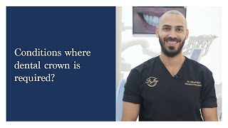 When is a dental crown necessary [upl. by Larok]