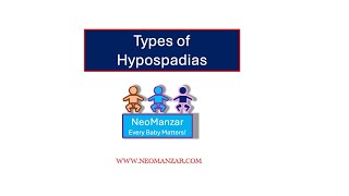 Hypospadias Types Newborn Infants [upl. by Nady]