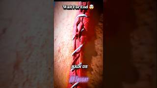 How stitches work 🤔 shorts viral facts trendingshorts viralvideo [upl. by Akayas71]