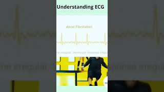 How to understand ECG report 🩺🤍 [upl. by Maharba484]