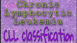 Chronic Lymphocytic Leukemia [upl. by Karub875]