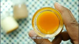 Natural Remedy for Varicose Veins Simple DIY Treatment to Improve Circulation [upl. by Erlewine]