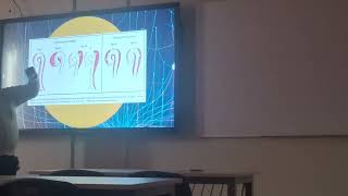 SEMIO B  SEMIOLOGIA CARDIOVASCULAR SINDROMES AORTICOS [upl. by Nylknarf909]