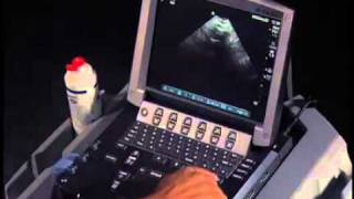 How To Transabdominal View of the Female Pelvis with Ultrasound [upl. by Wootan292]