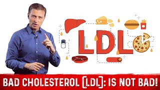 What is LDL Cholesterol – DrBerg on LDL Bad Cholesterol Part 4 [upl. by Horne280]