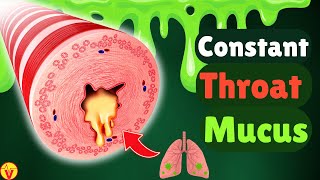 6 Real Causes of Phlegm amp Mucus in Your Throat Stop Constant Throat Clearing  VisitJoy [upl. by Ebbie924]