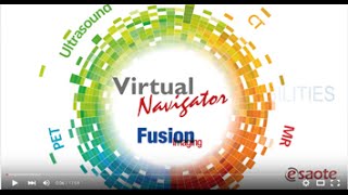 Virtual Navigator amp fusion imaging  Clinical Cases [upl. by Ohaus]