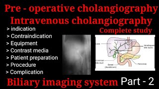 Preoperative cholangiography  Intravenous cholangiography  IVC  biliary imaging system part  2 [upl. by Metzgar]