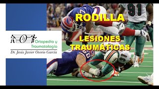 Lesiones Traumáticas de Rodilla [upl. by Eldoria]