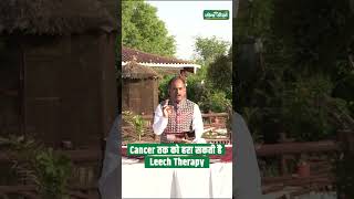 What is leech therapy  Leech therapy for Cancer  Leech therapy for pain relief  Acharya Manish ji [upl. by Enimassej894]