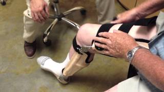 Orthotics and Prosthetics  Medicine Biomechanics and Design [upl. by Acirderf374]