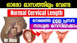 Cervical Length During Pregnancy MalayalamShort CervixCervical Dilation [upl. by Aleunam460]