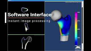 3DSHAPER® 3DDXA Technology Add 3D to Hip DXA [upl. by Elianore]