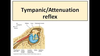 Tympanic reflex [upl. by Ahsiet62]