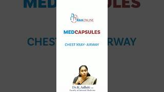 MEDCAPSULES  Chest XRAY Airway  by DrKAdhiti  shorts [upl. by Airehs337]