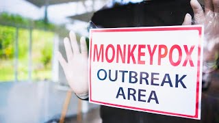 Monkeypox Virus What You Need to Know😱 [upl. by Alolomo114]