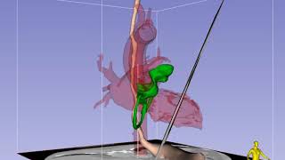 Transgastric MidPapillary ShortAxis Imaging Plane in TEE  Standard View [upl. by Treble49]