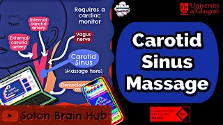 Carotid sinus massage Rapid Review [upl. by Onurb]