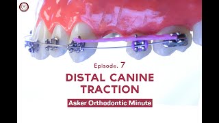 Distal Canine Traction Asker Orthodontic Minute Episode 7 [upl. by Ernesta]